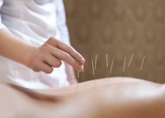 L’Acupuncture : Une Ancienne Pratique pour un Bien-Être Moderne